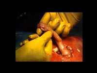 Samuel "A mão da ESPERANÇA"