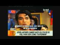 Impacto: Jóvenes se operan para parecerse a sus ídolos